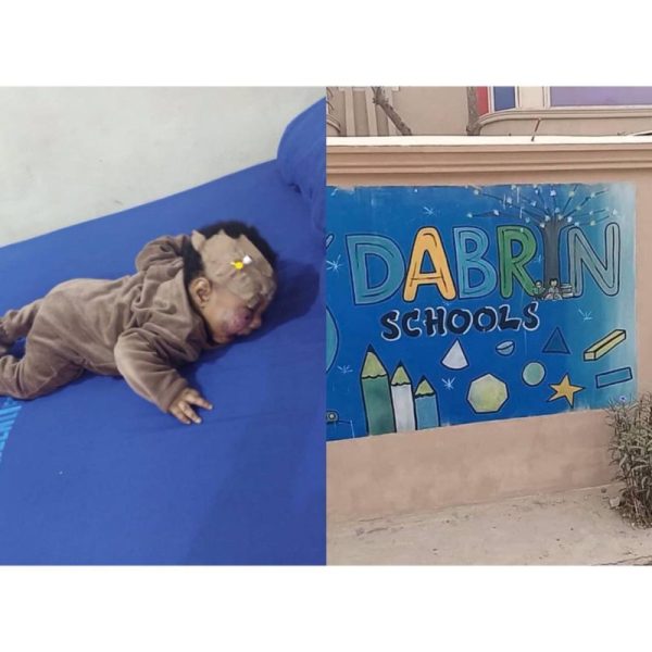 baby injured at daycare