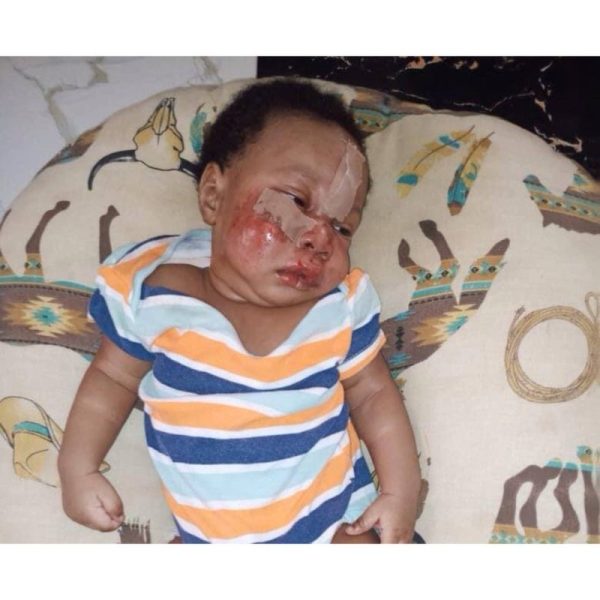 baby injured at daycare