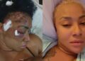 Angela Okorie bullet fragments in head