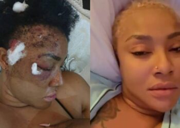 Angela Okorie bullet fragments in head