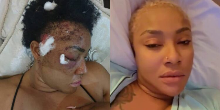 Angela Okorie bullet fragments in head