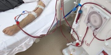 kidney dialysis subsidy