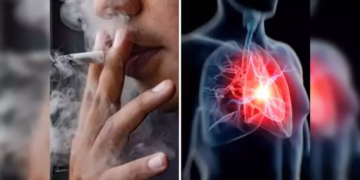 Cardiac arrest prevention