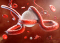 Ebola