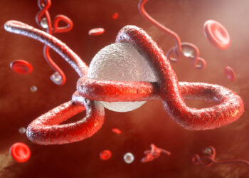 Ebola
