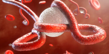 Ebola