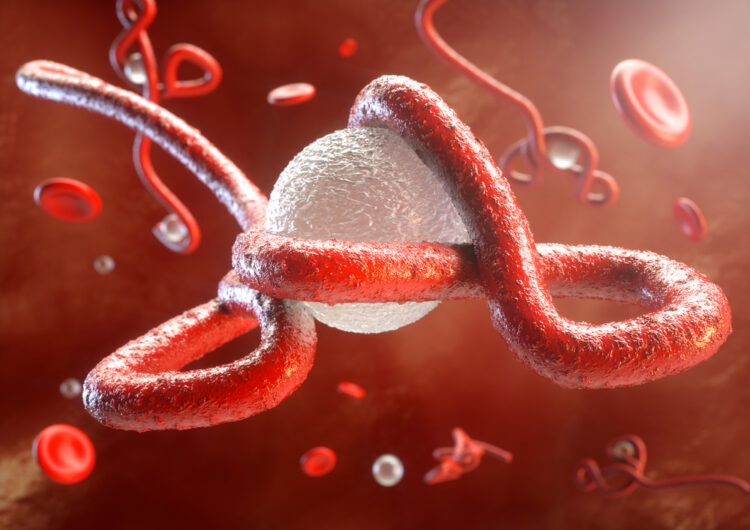 Ebola